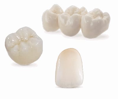 Cirkonio keramikos protezai